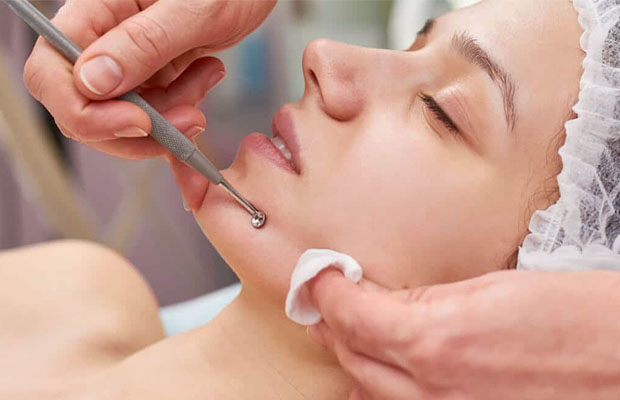 How To Use The Blackhead Tool? Blackhead Extractor Guide